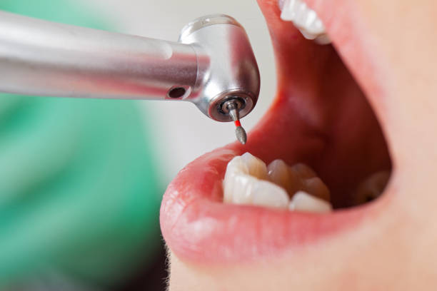 Best Emergency Dental Care for Trauma or Injury in Silverdale, WA
